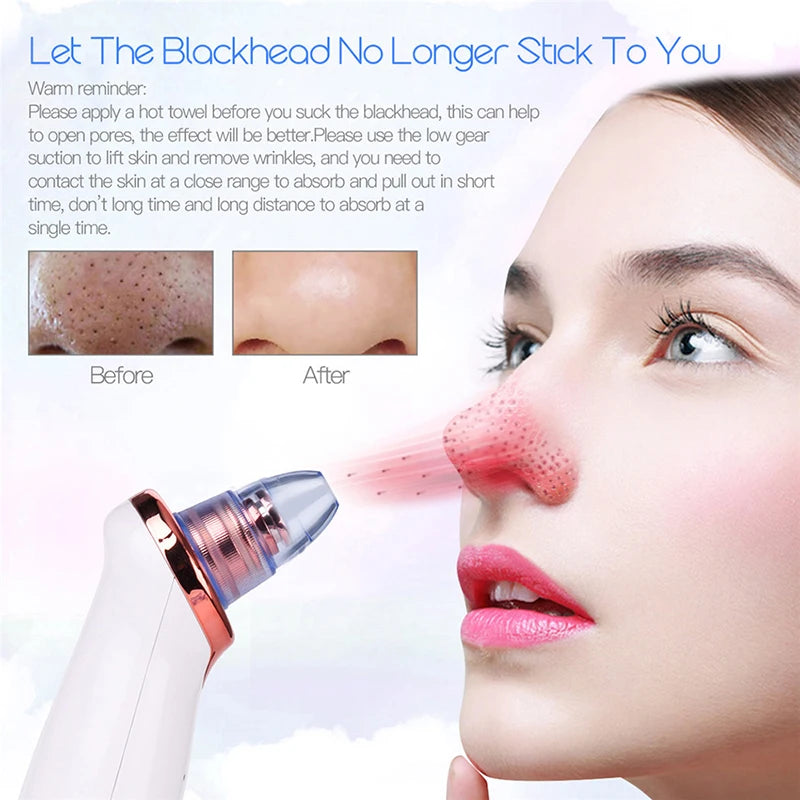 VELOURA Blackhead Remover Vacuum – USB